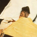 Майкла Джексона везут в больницу после ожога